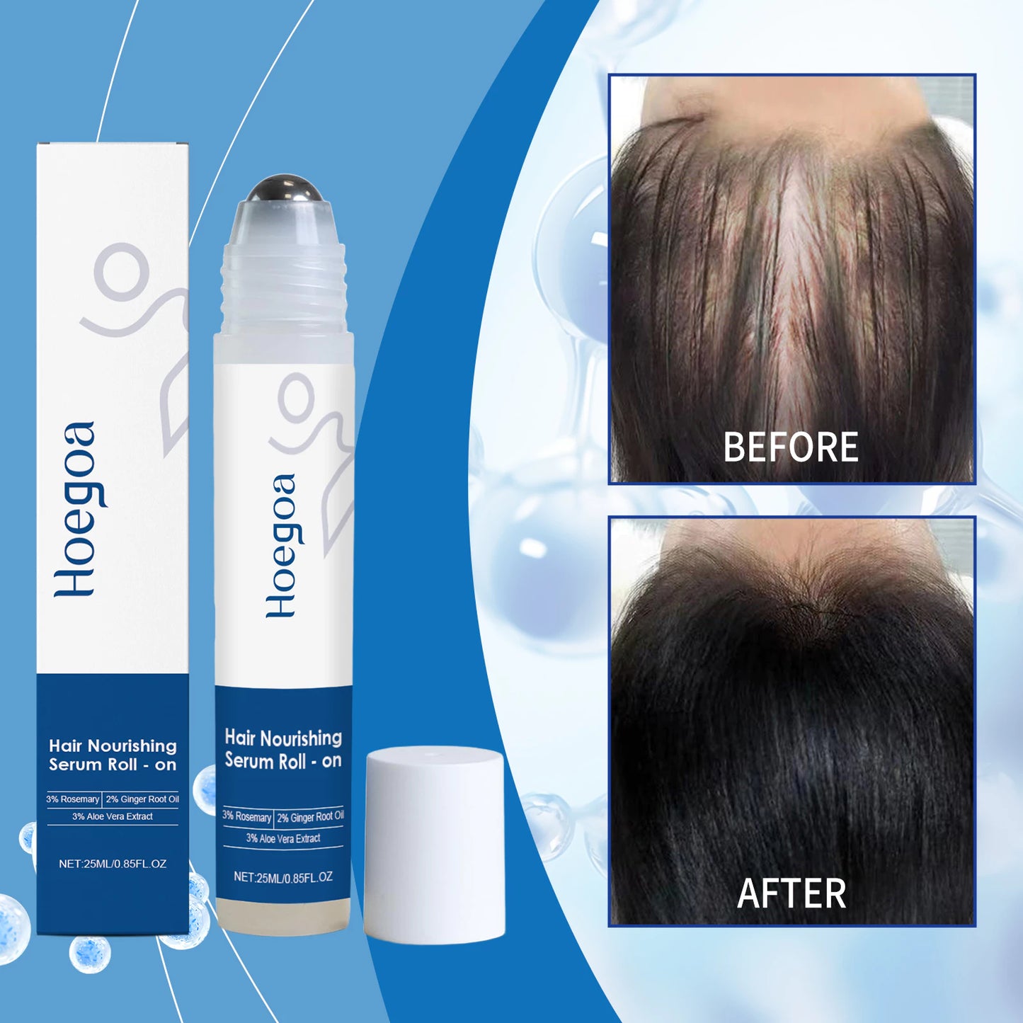 BodyWise Hair Growth - Sérum Capilar Anticaída y Crecimiento Intensivo 2x1
